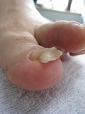 鍼灸治療・整体・巻き爪治療