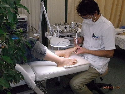 接骨院での巻き爪補正治療